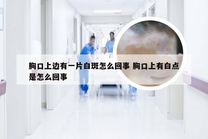 胸口上边有一片白斑怎么回事 胸口上有白点是怎么回事