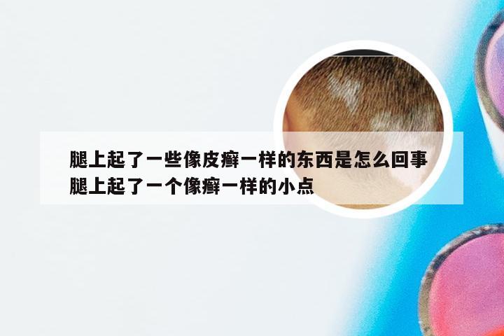 腿上起了一些像皮癣一样的东西是怎么回事 腿上起了一个像癣一样的小点