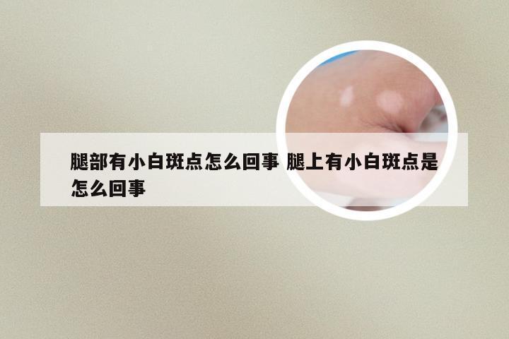 腿部有小白斑点怎么回事 腿上有小白斑点是怎么回事