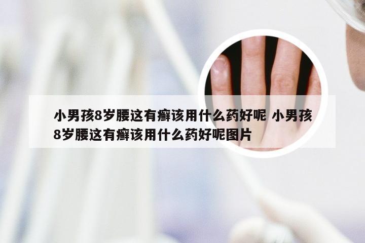 小男孩8岁腰这有癣该用什么药好呢 小男孩8岁腰这有癣该用什么药好呢图片