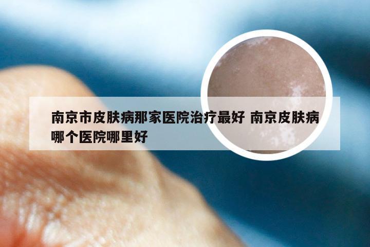 南京市皮肤病那家医院治疗最好 南京皮肤病哪个医院哪里好