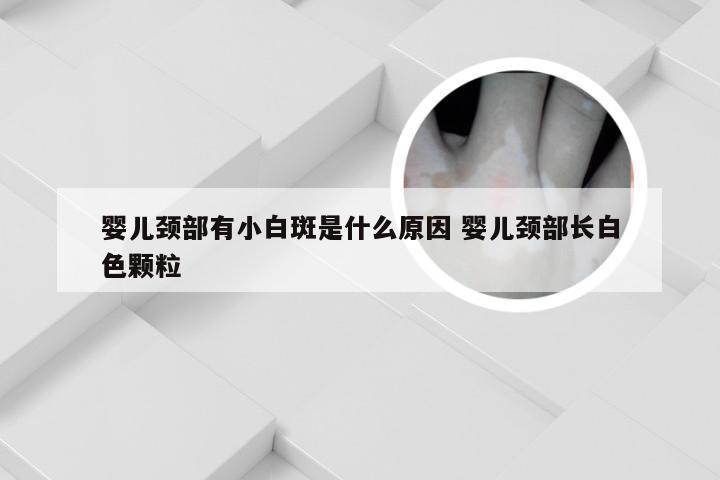 婴儿颈部有小白斑是什么原因 婴儿颈部长白色颗粒