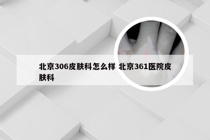北京306皮肤科怎么样 北京361医院皮肤科