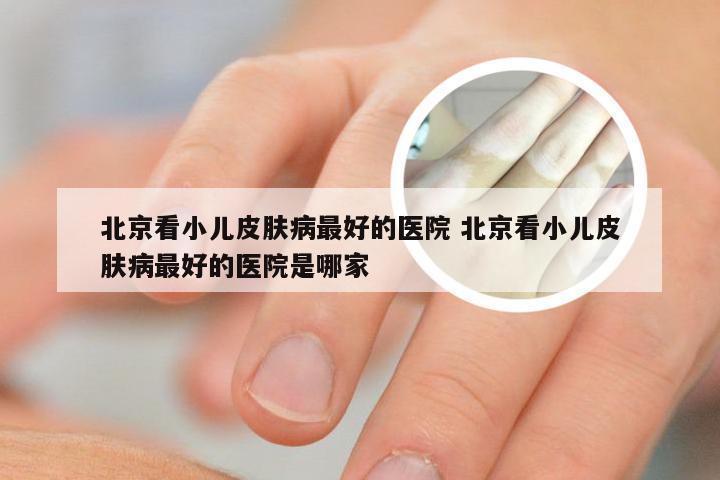 北京看小儿皮肤病最好的医院 北京看小儿皮肤病最好的医院是哪家