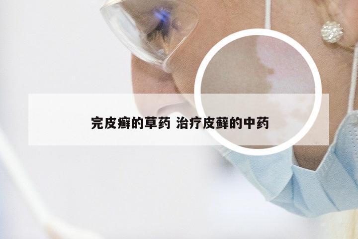 完皮癣的草药 治疗皮藓的中药