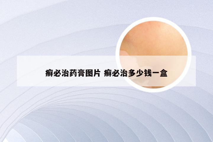 癣必治药膏图片 癣必治多少钱一盒