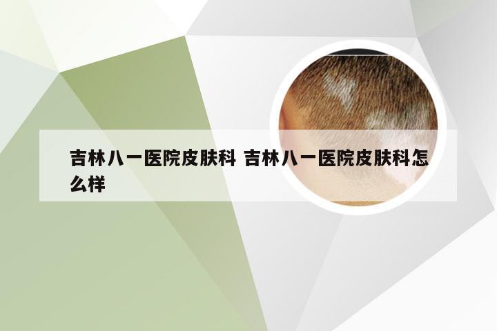 吉林八一医院皮肤科 吉林八一医院皮肤科怎么样