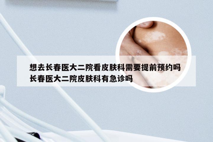 想去长春医大二院看皮肤科需要提前预约吗 长春医大二院皮肤科有急诊吗
