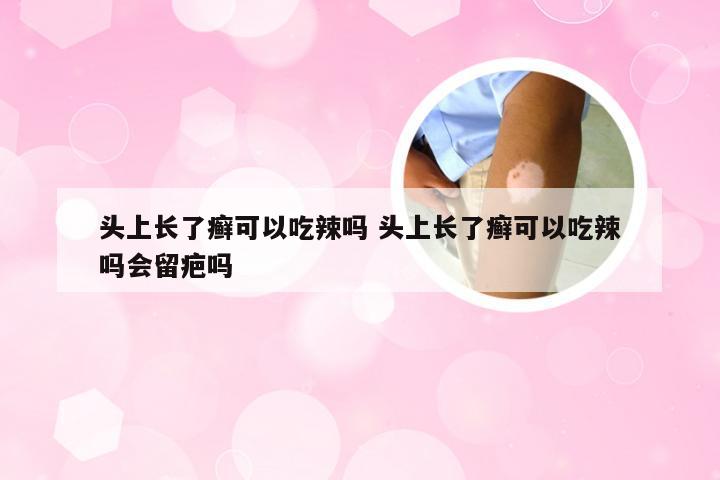 头上长了癣可以吃辣吗 头上长了癣可以吃辣吗会留疤吗