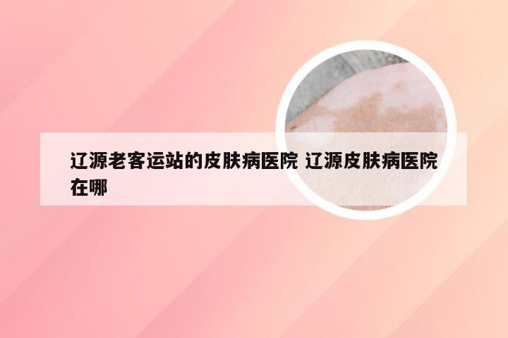 辽源老客运站的皮肤病医院 辽源皮肤病医院在哪