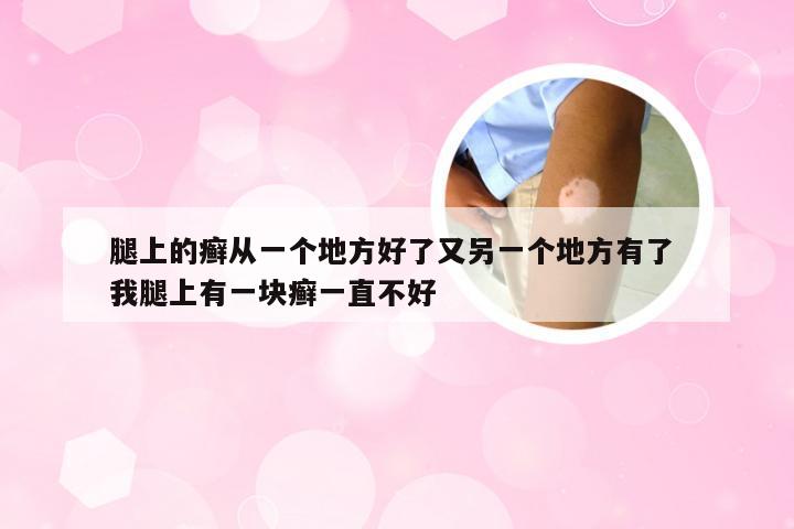 腿上的癣从一个地方好了又另一个地方有了 我腿上有一块癣一直不好
