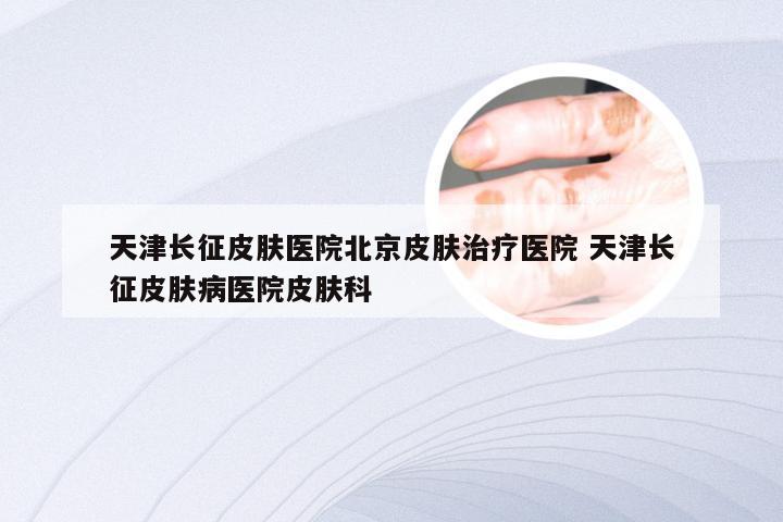 天津长征皮肤医院北京皮肤治疗医院 天津长征皮肤病医院皮肤科