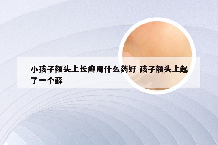 小孩子额头上长癣用什么药好 孩子额头上起了一个藓