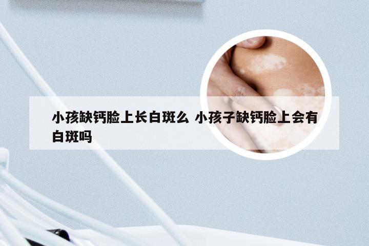 小孩缺钙脸上长白斑么 小孩子缺钙脸上会有白斑吗