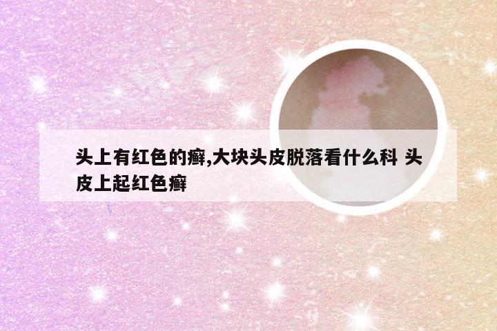 头上有红色的癣,大块头皮脱落看什么科 头皮上起红色癣