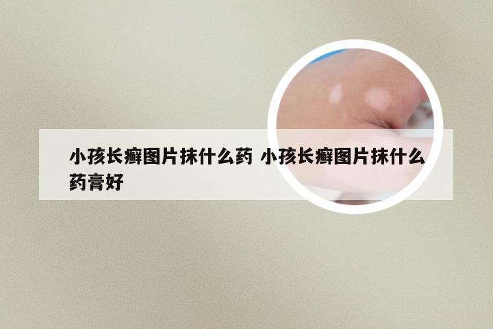 小孩长癣图片抹什么药 小孩长癣图片抹什么药膏好