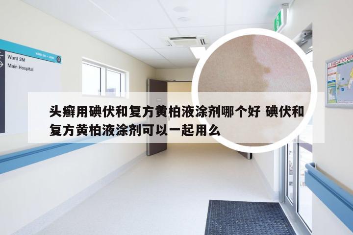 头癣用碘伏和复方黄柏液涂剂哪个好 碘伏和复方黄柏液涂剂可以一起用么