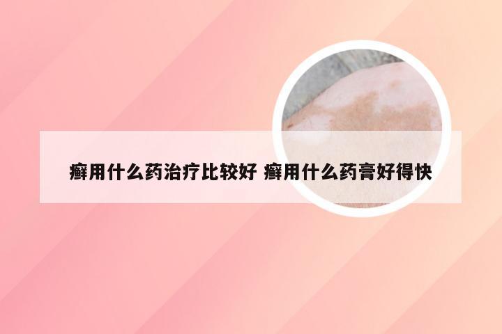 癣用什么药治疗比较好 癣用什么药膏好得快