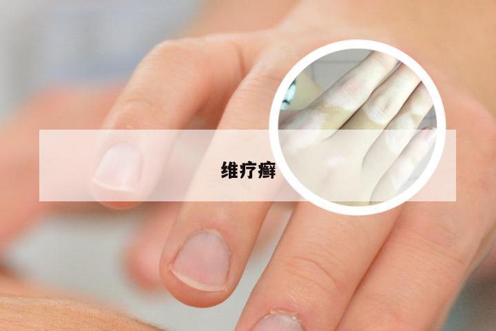 维疗癣
