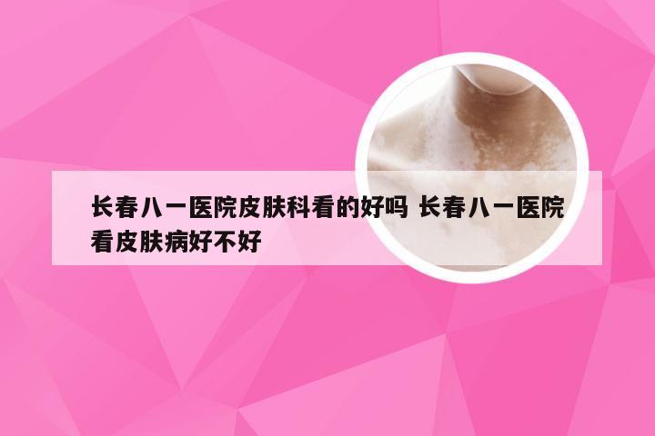 长春八一医院皮肤科看的好吗 长春八一医院看皮肤病好不好