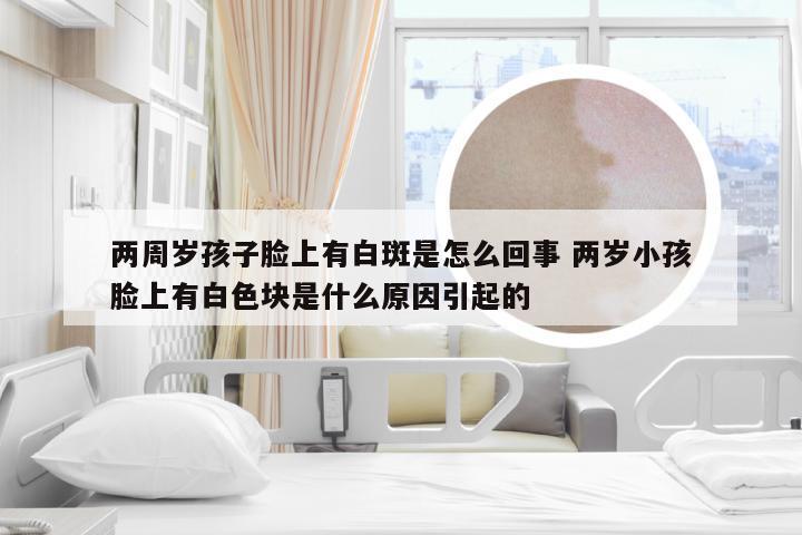 两周岁孩子脸上有白斑是怎么回事 两岁小孩脸上有白色块是什么原因引起的
