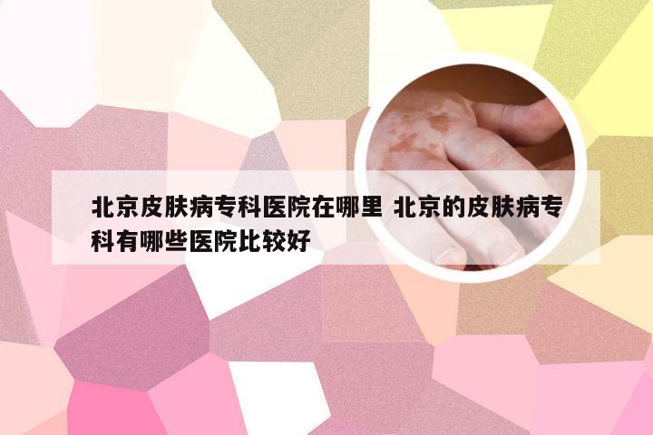 北京皮肤病专科医院在哪里 北京的皮肤病专科有哪些医院比较好