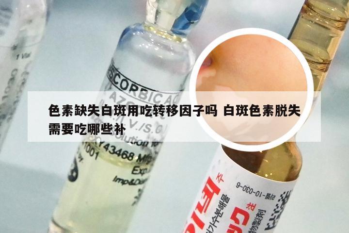 色素缺失白斑用吃转移因子吗 白斑色素脱失需要吃哪些补