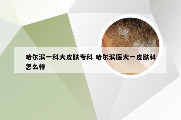 哈尔滨一科大皮肤专科 哈尔滨医大一皮肤科怎么样