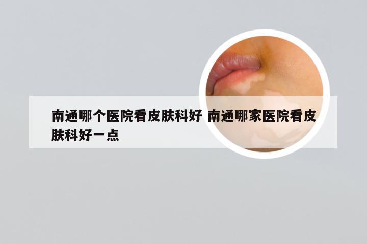 南通哪个医院看皮肤科好 南通哪家医院看皮肤科好一点