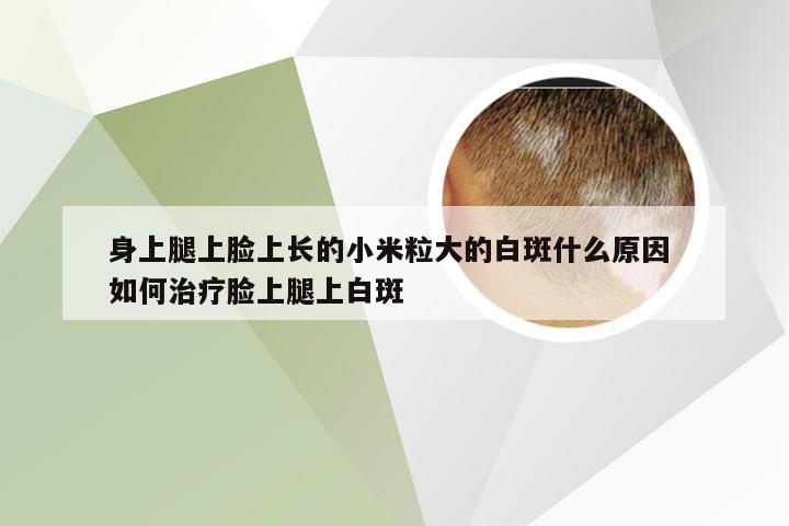 身上腿上脸上长的小米粒大的白斑什么原因 如何治疗脸上腿上白斑