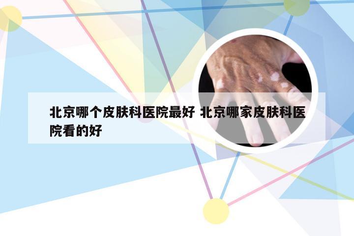 北京哪个皮肤科医院最好 北京哪家皮肤科医院看的好