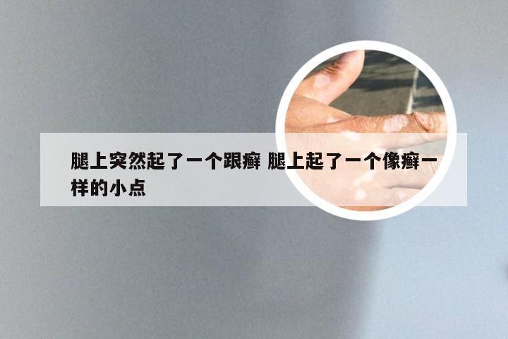 腿上突然起了一个跟癣 腿上起了一个像癣一样的小点