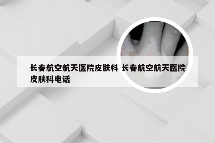长春航空航天医院皮肤科 长春航空航天医院皮肤科电话