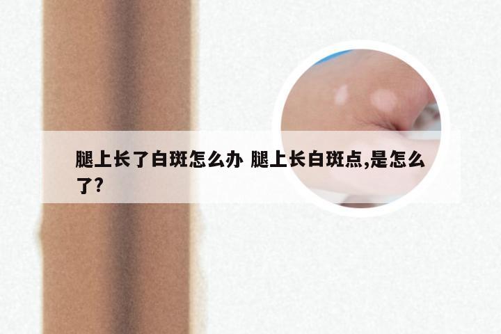 腿上长了白斑怎么办 腿上长白斑点,是怎么了?