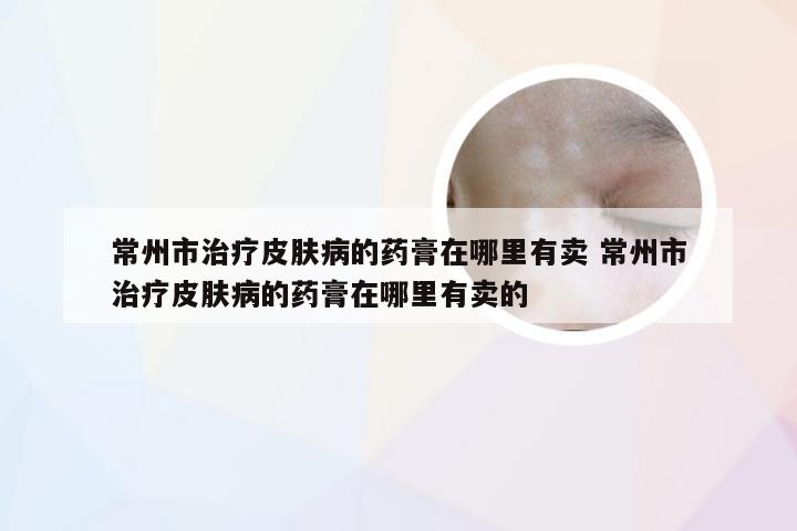 常州市治疗皮肤病的药膏在哪里有卖 常州市治疗皮肤病的药膏在哪里有卖的