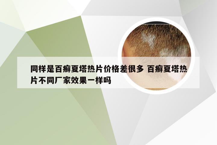 同样是百癣夏塔热片价格差很多 百癣夏塔热片不同厂家效果一样吗