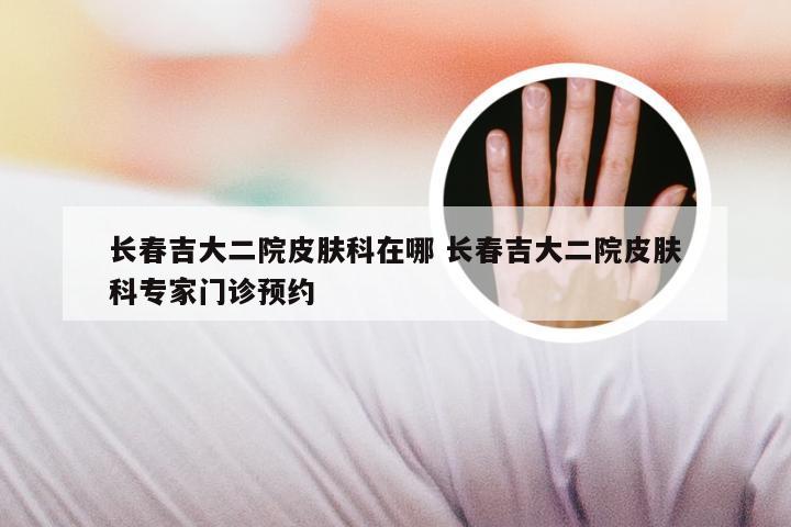 长春吉大二院皮肤科在哪 长春吉大二院皮肤科专家门诊预约