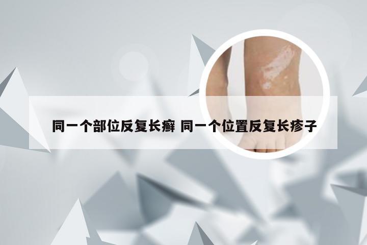 同一个部位反复长癣 同一个位置反复长疹子