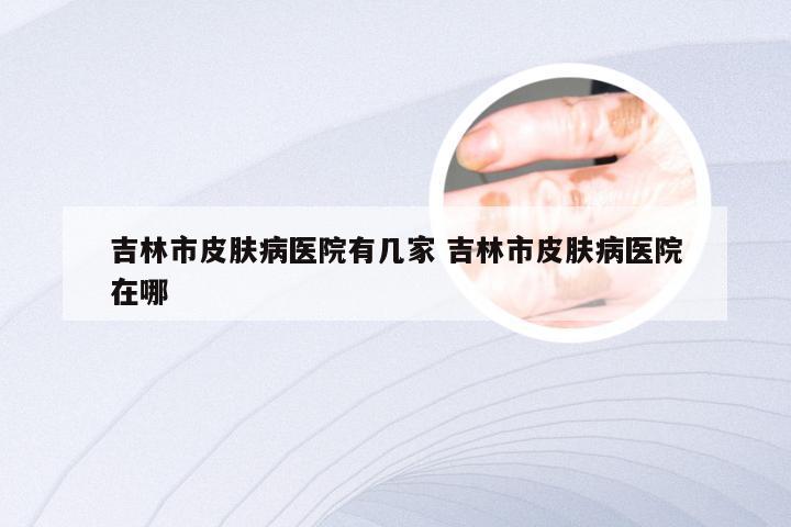 吉林市皮肤病医院有几家 吉林市皮肤病医院在哪