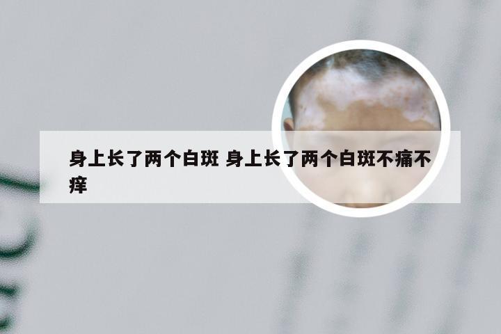 身上长了两个白斑 身上长了两个白斑不痛不痒