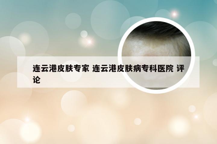 连云港皮肤专家 连云港皮肤病专科医院 评论