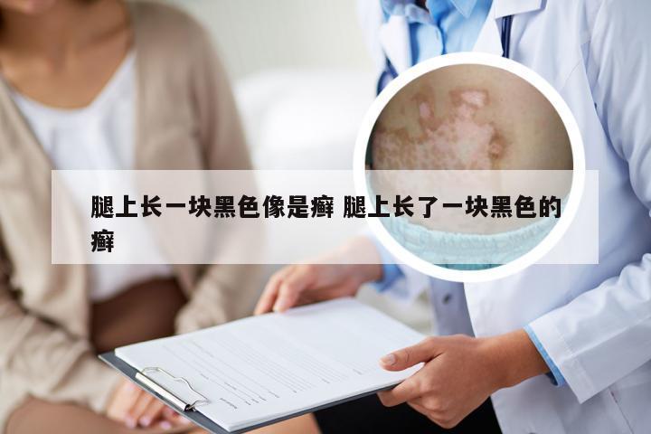 腿上长一块黑色像是癣 腿上长了一块黑色的癣