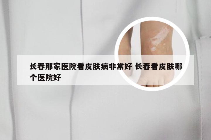 长春那家医院看皮肤病非常好 长春看皮肤哪个医院好