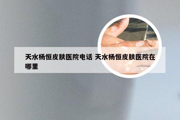天水杨恒皮肤医院电话 天水杨恒皮肤医院在哪里
