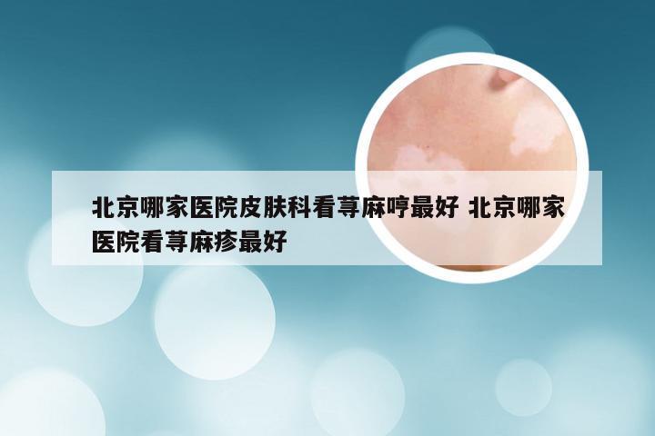 北京哪家医院皮肤科看荨麻哼最好 北京哪家医院看荨麻疹最好