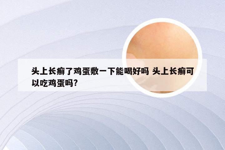 头上长癣了鸡蛋敷一下能喝好吗 头上长癣可以吃鸡蛋吗?