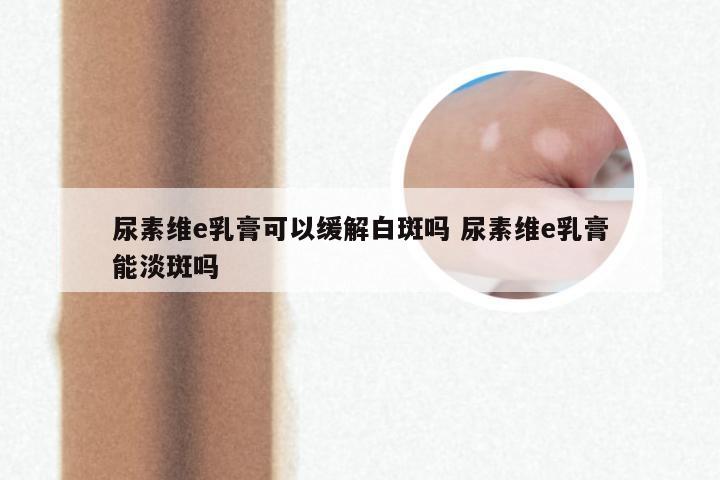 尿素维e乳膏可以缓解白斑吗 尿素维e乳膏能淡斑吗