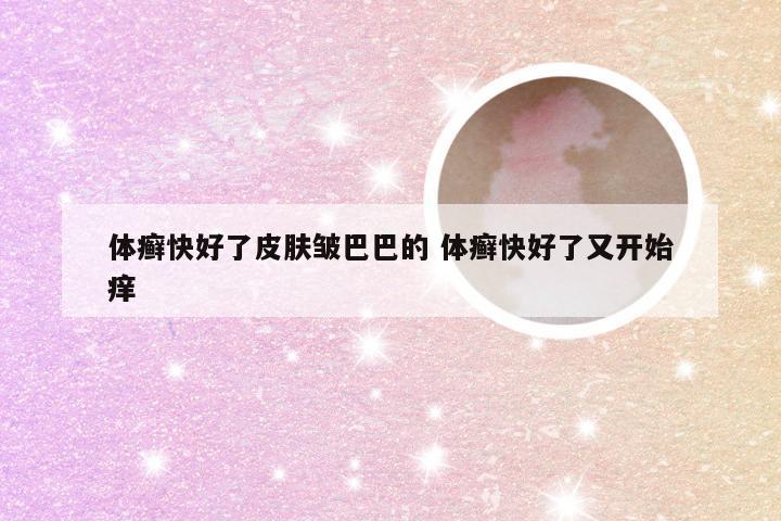 体癣快好了皮肤皱巴巴的 体癣快好了又开始痒