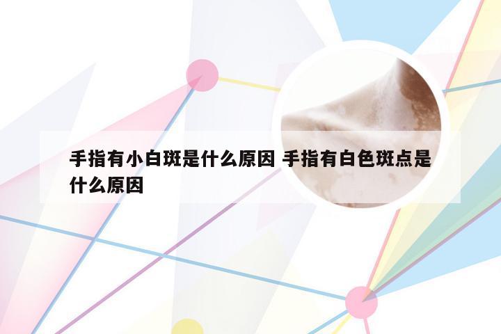 手指有小白斑是什么原因 手指有白色斑点是什么原因