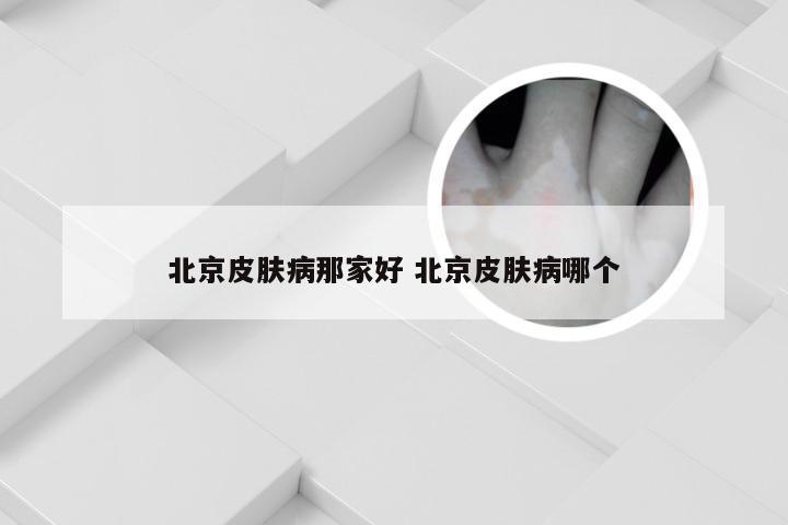 北京皮肤病那家好 北京皮肤病哪个